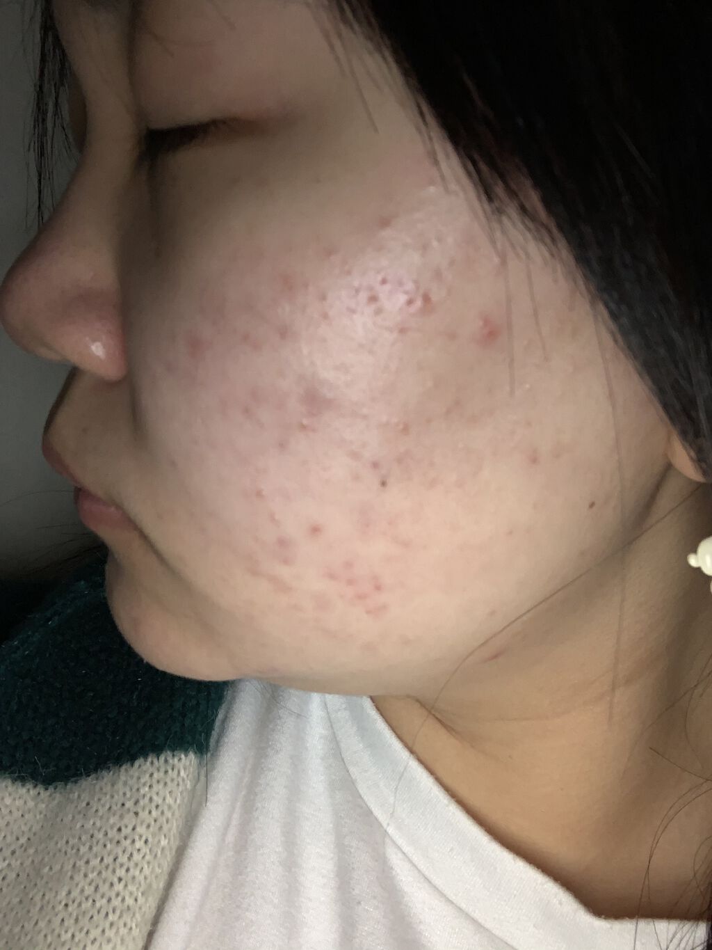 ティーツリーケア ソリューション エッセンシャルマスクEX/MEDIHEAL/シートマスク・パックを使ったクチコミ（3枚目）