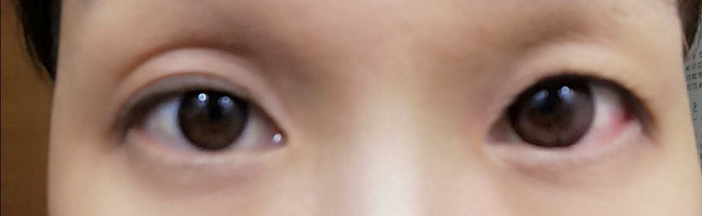 TeAmo 1month/TeAmo/1ヶ月(1MONTH)カラコンを使ったクチコミ(3枚目)