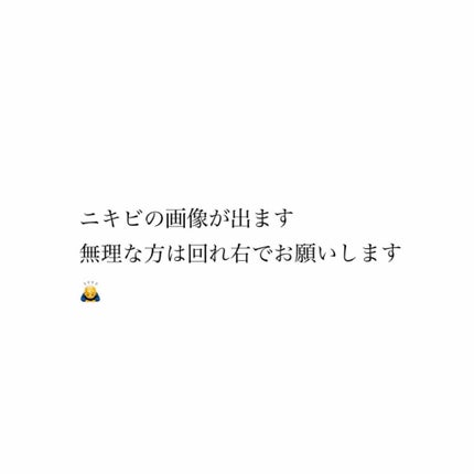 クリアトライアルセット M(しっとりタイプ)/オルビス/トライアルキットを使ったクチコミ(1枚目)