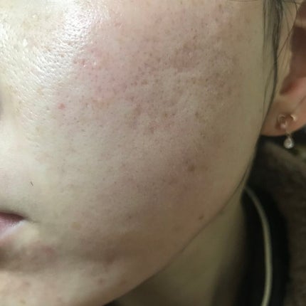 Cサスペンション23+HAスフィア2フェイスクリーム/The Ordinary/美容液を使ったクチコミ(2枚目)