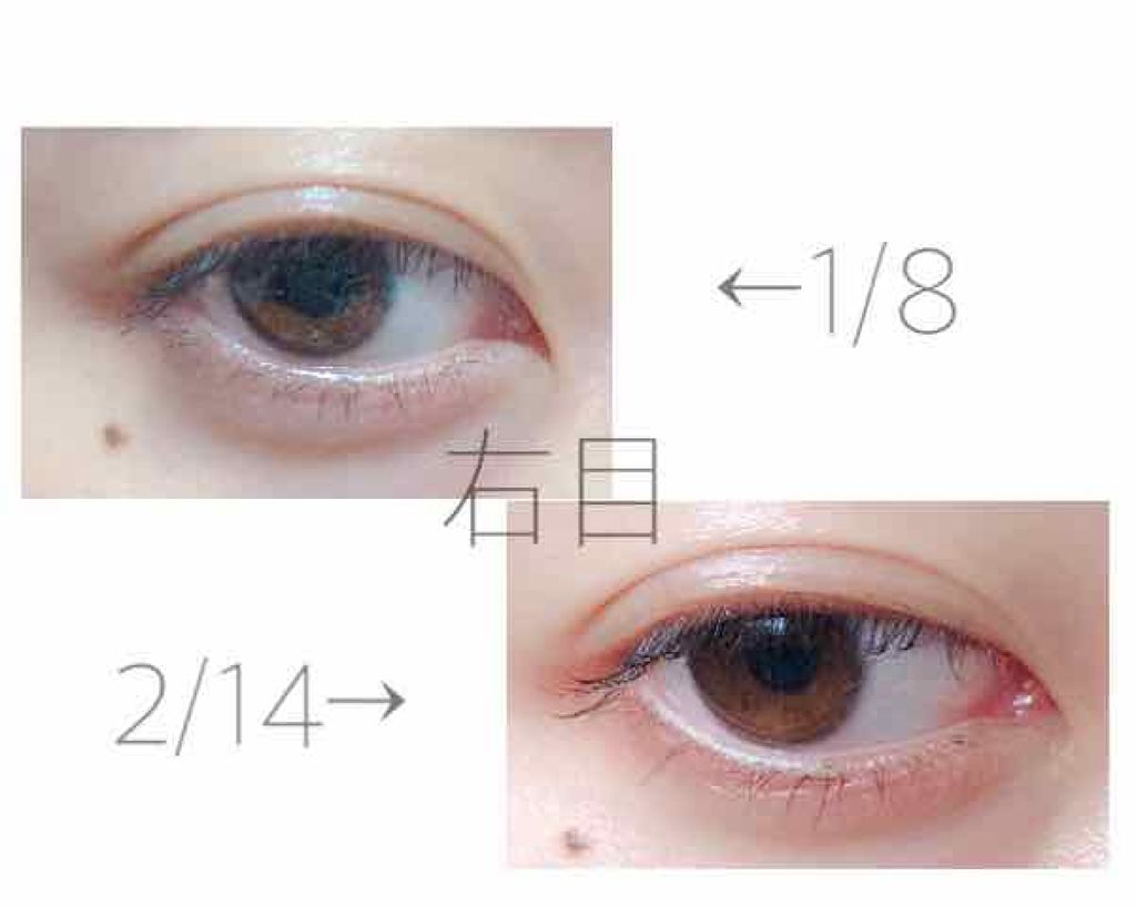 砂糖 on LIPS 「⚠️2枚目以降に目の画像があります⚠️みなさんこんばんは砂糖で..」(3枚目)