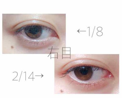 砂糖 on LIPS 「⚠️2枚目以降に目の画像があります⚠️みなさんこんばんは砂糖で..」(3枚目)