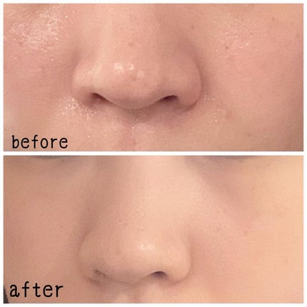 シカマイルドクレンジングバーム/VT/クレンジングバームを使ったクチコミ(5枚目)