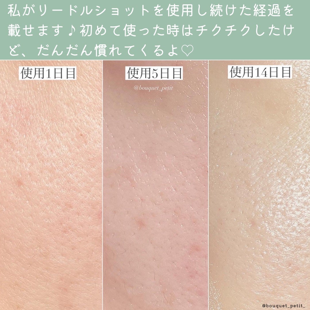 リードルショット100/VT/美容液を使ったクチコミ(4枚目)