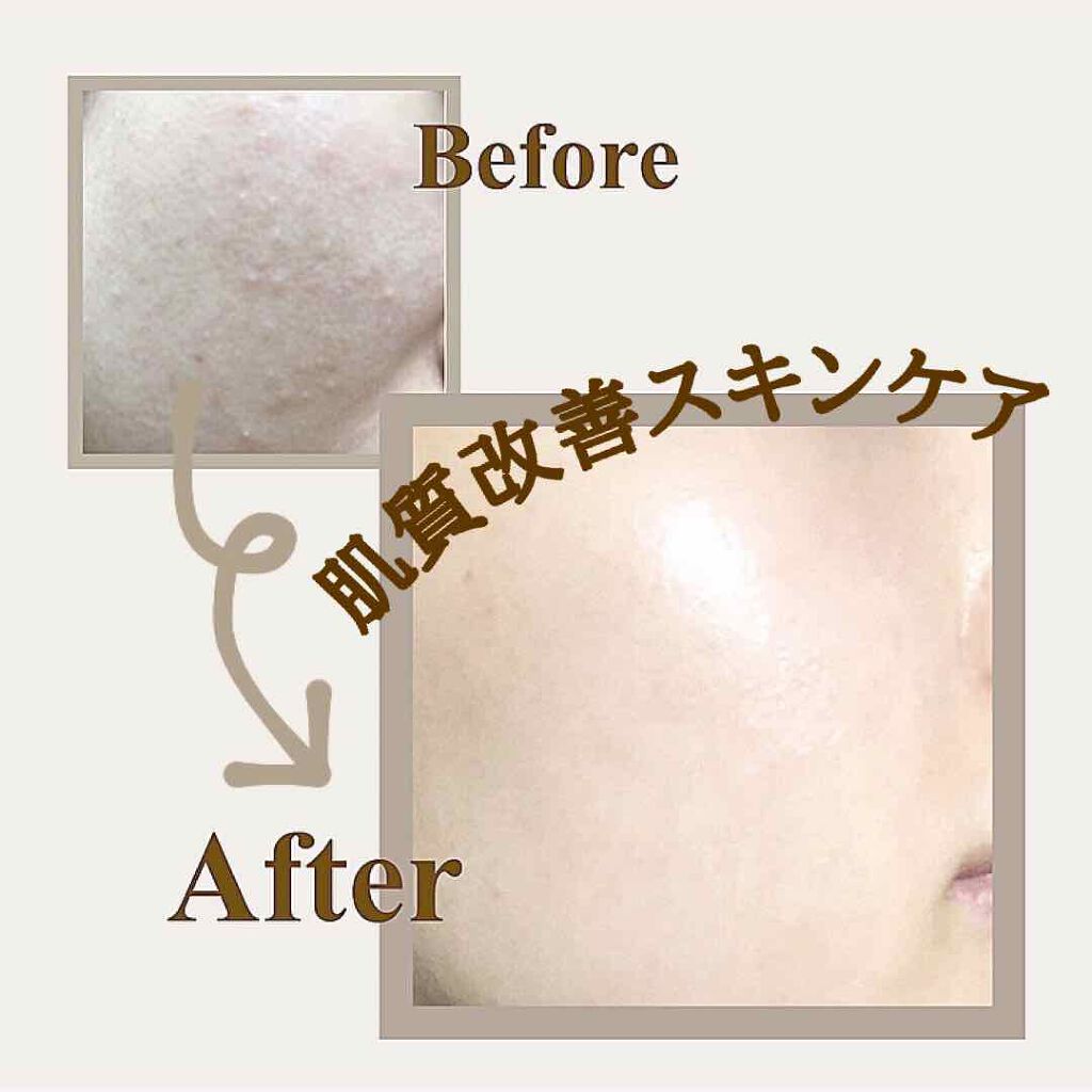 ザ・タイムR アクア/IPSA/化粧水を使ったクチコミ(1枚目)