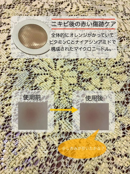 スポットイーザーオレンジ/NOLAHOUR/にきびパッチを使ったクチコミ(3枚目)