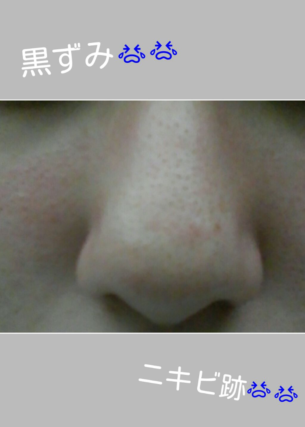 重曹スクラブ洗顔/毛穴撫子/スクラブ・ゴマージュを使ったクチコミ（2枚目）