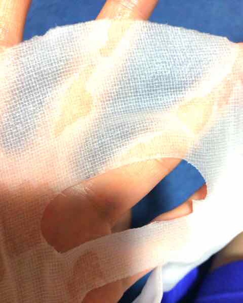 Nurse Healing Mask/MERBLISS/シートマスク・パックを使ったクチコミ(2枚目)