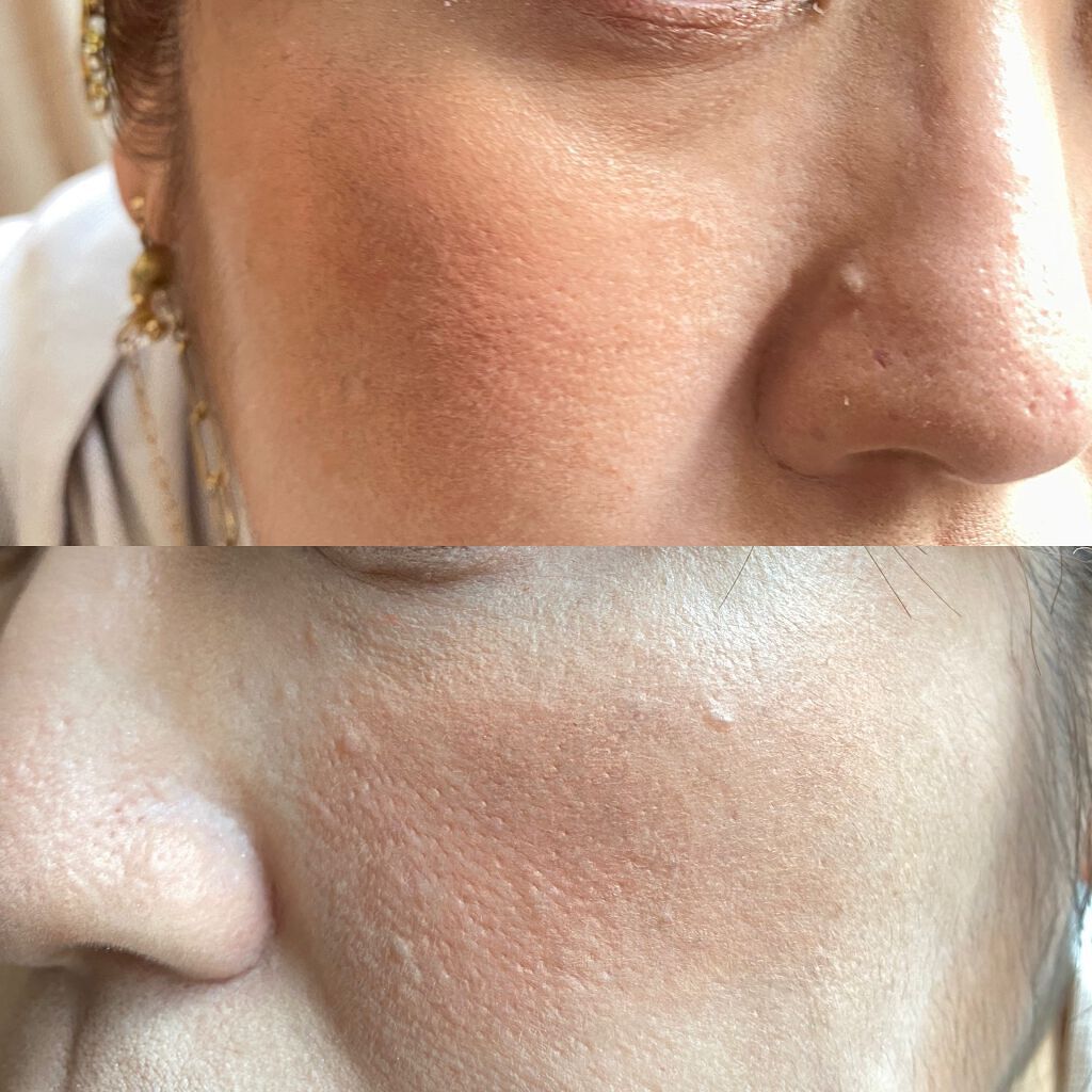 レ ベージュ オー ドゥ ブラッシュ/CHANEL/リキッドチークを使ったクチコミ(3枚目)