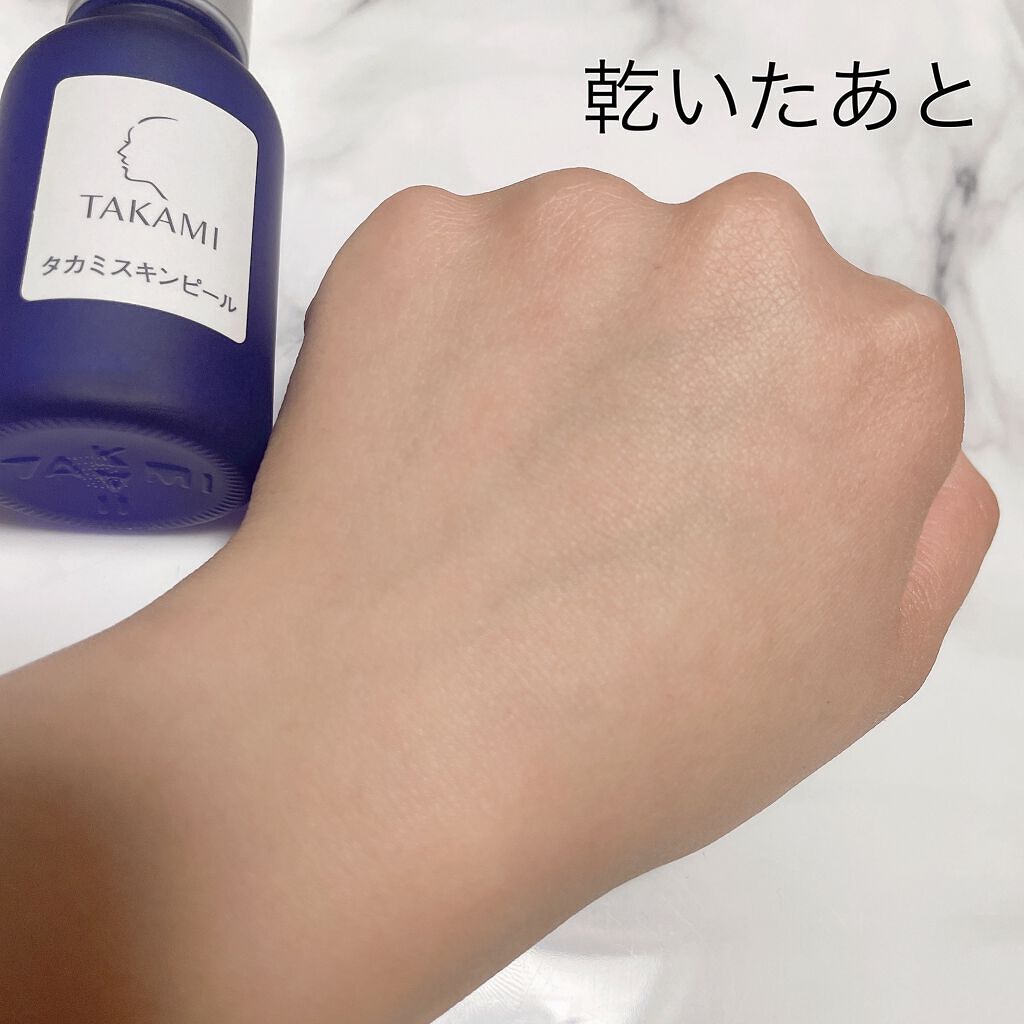 タカミスキンピール/タカミ/ブースター・導入液を使ったクチコミ(5枚目)