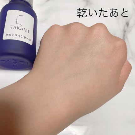 タカミスキンピール/タカミ/ブースター・導入液を使ったクチコミ(5枚目)
