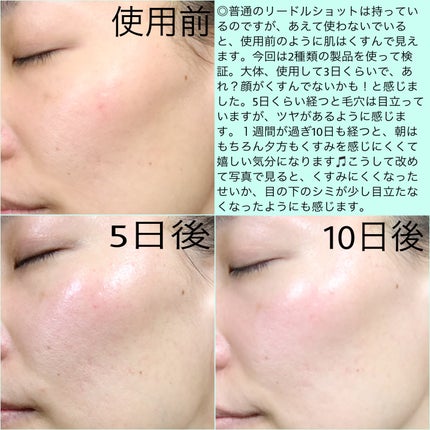 プロCICAリードルショット100/VT/ブースター・導入液を使ったクチコミ(4枚目)