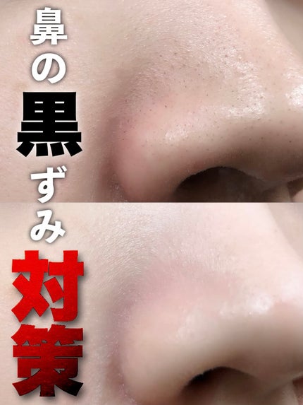 パーフェクトワンフォーカス スムースクレンジングバーム ディープブラック/PERFECT ONE  FOCUS/クレンジングバームを使ったクチコミ(1枚目)