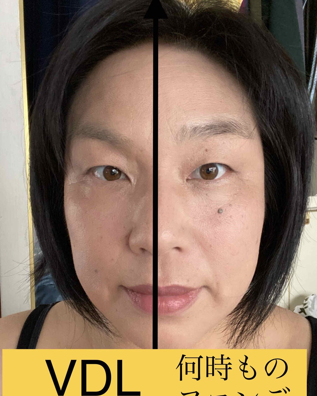 EXPERT METAL CUSHION FOUNDATION (エキスパートメタルクッションファンデーション) SPF50+ PA+++/VDL/クッションファンデーションを使ったクチコミ(3枚目)