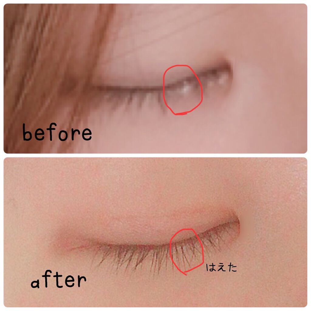 スカルプD ボーテ ピュアフリーアイラッシュセラム/アンファー(スカルプD)/まつげ美容液を使ったクチコミ（3枚目）