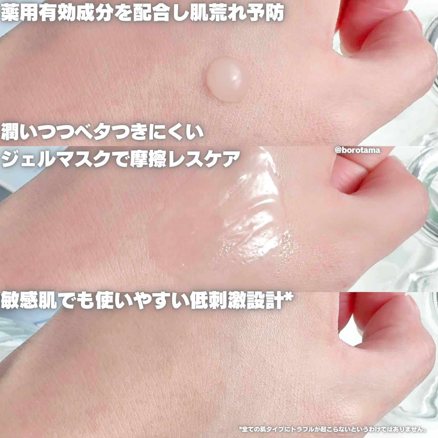 モイストケア ローション MB/d プログラム/化粧水を使ったクチコミ(4枚目)