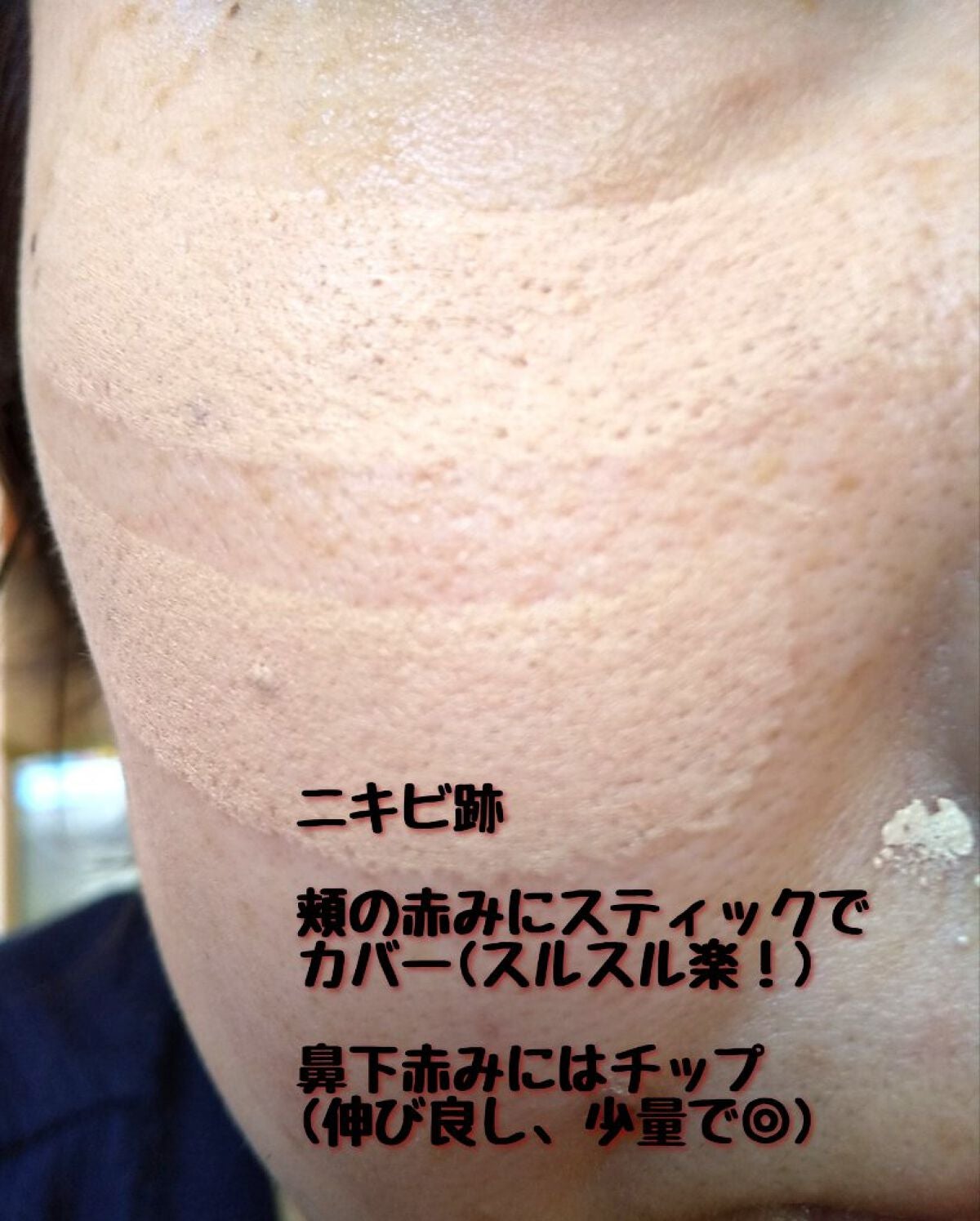 マスクフィットオールカバーデュアルコンシーラー/TIRTIR(ティルティル)/コンシーラーを使ったクチコミ(7枚目)
