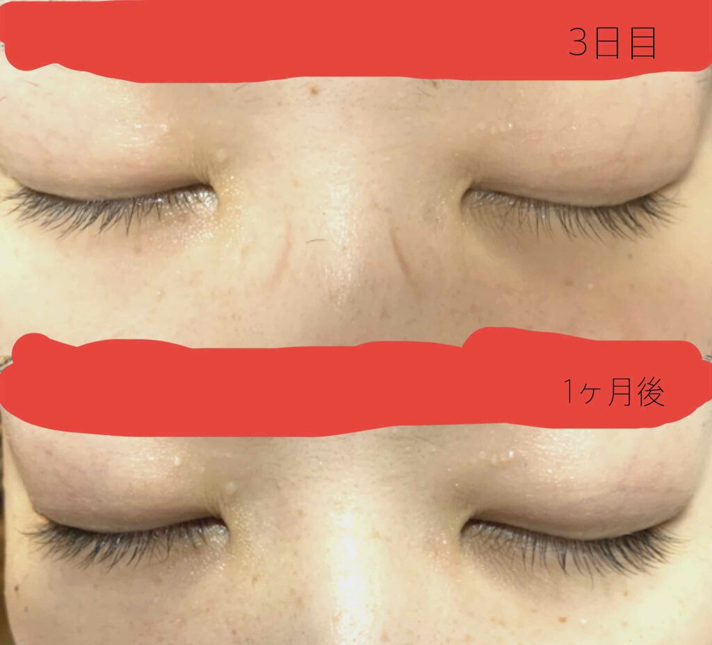 EMAKED(エマーキット)/水橋保寿堂製薬/まつげ美容液を使ったクチコミ(1枚目)