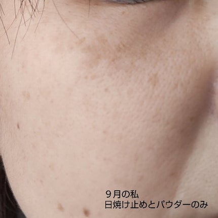 シナールエクシア ホワイトメディカルエッセンス/シオノギ製薬/美容液を使ったクチコミ(5枚目)