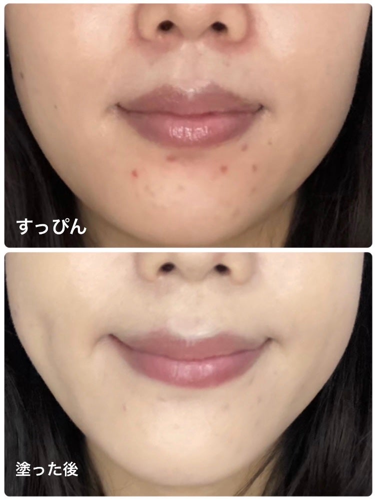 ピンクティーツリーカバーアップグロウクッション/APLIN/クッションファンデーションを使ったクチコミ(4枚目)