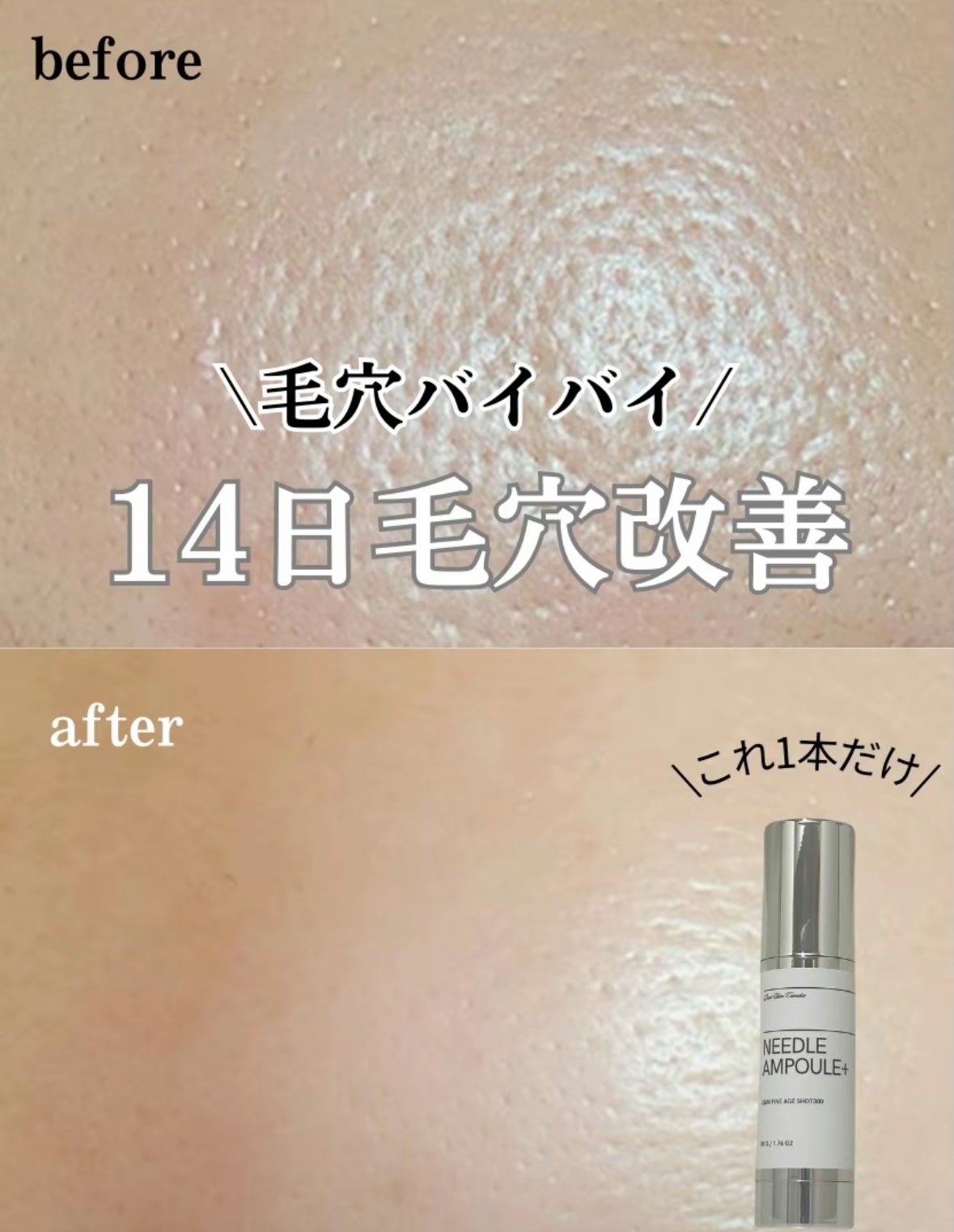 ユジムファインエイジショット300/Usim Cosmetics/美容液を使ったクチコミ(1枚目)