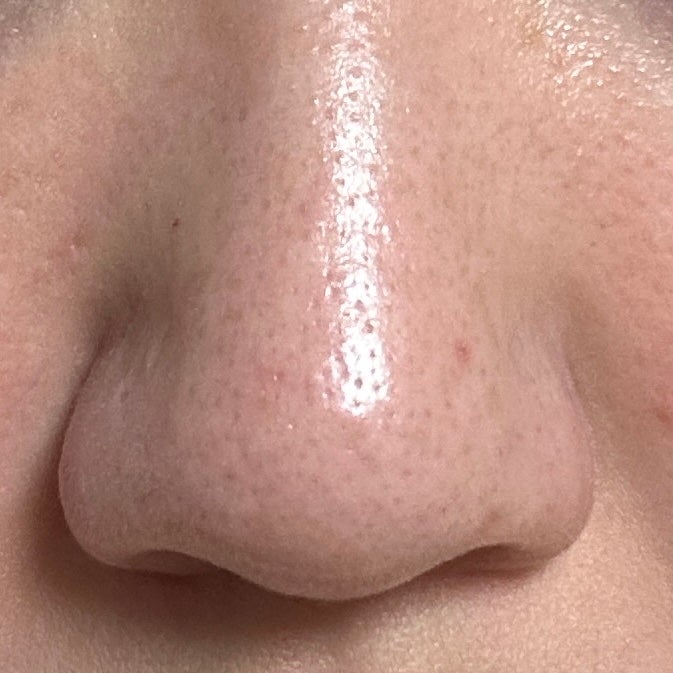 ピュアクレンジングバーム/manyo/クレンジングバームを使ったクチコミ(3枚目)