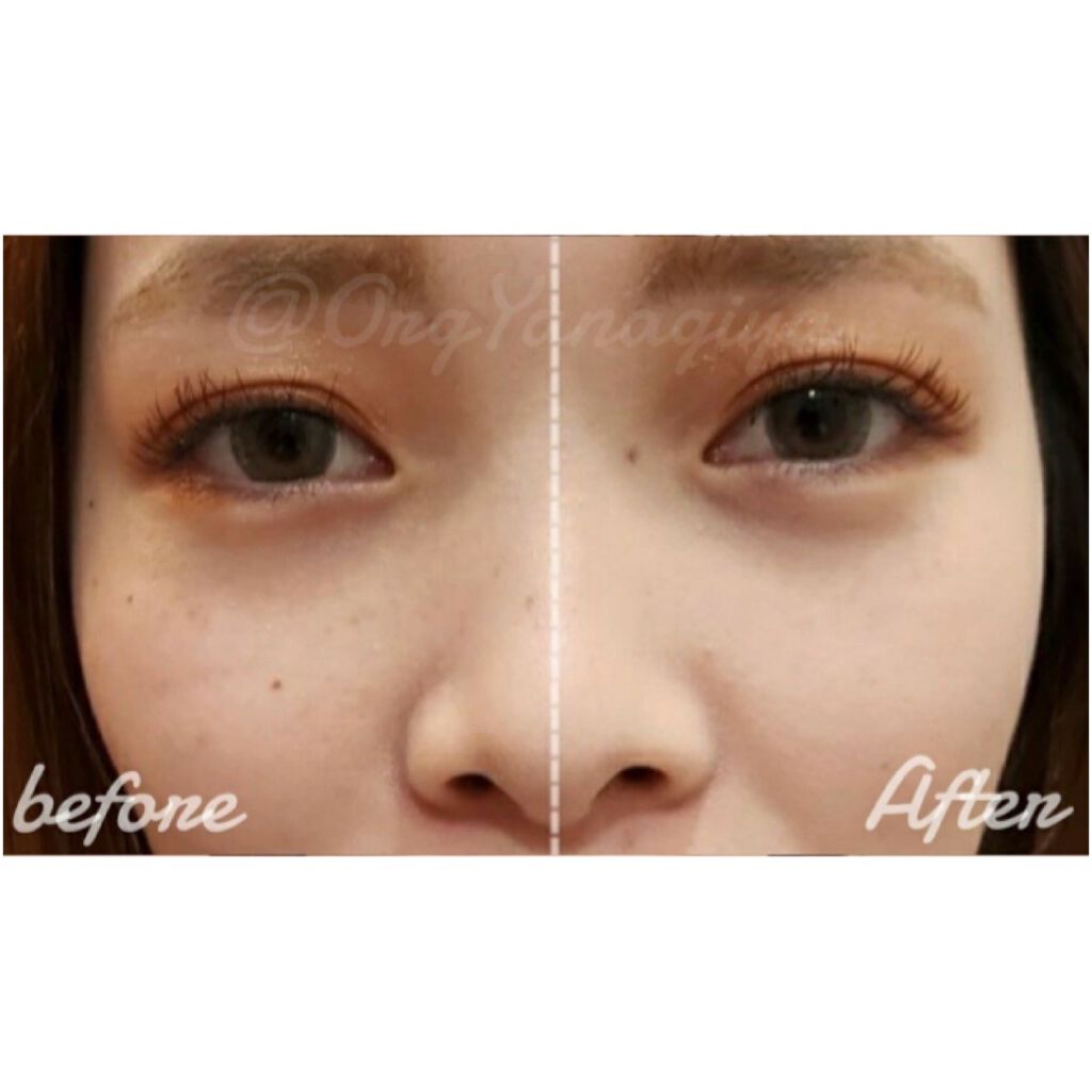 シンクロフィット パクト EX/ESPRIQUE/パウダーファンデーションを使ったクチコミ(5枚目)