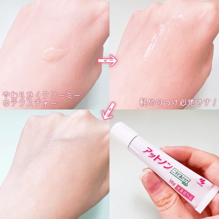 ニキビあとケアジェル/アットノン/その他スキンケアを使ったクチコミ(4枚目)