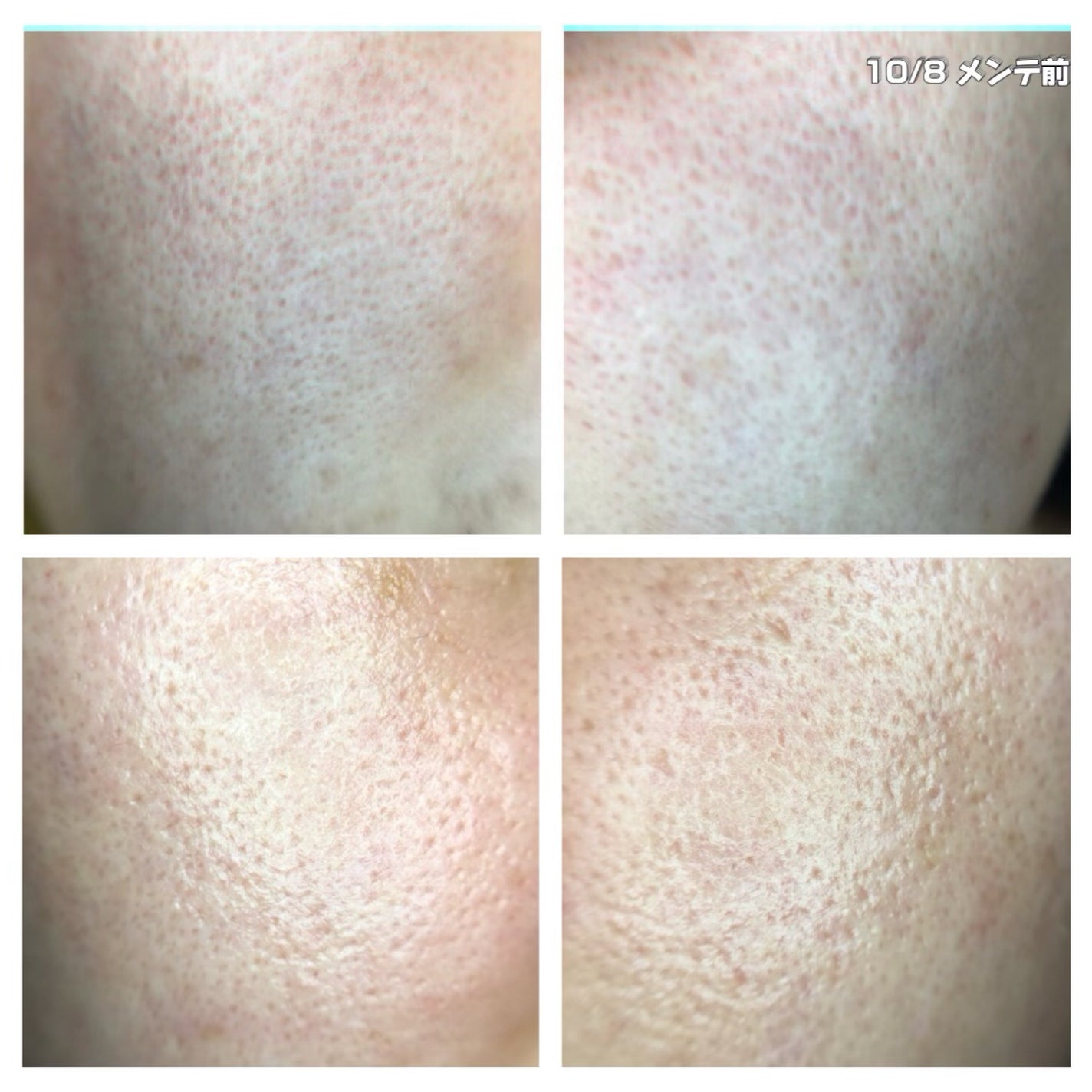 水溶性フラーレン/TOUT VERT/美容液を使ったクチコミ(3枚目)