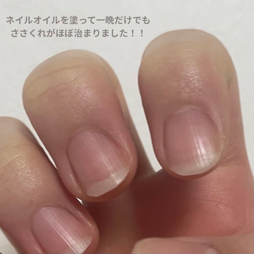 ネイルトリートメントオイル/カントリー&ストリーム/ネイルオイル・トリートメントを使ったクチコミ(3枚目)