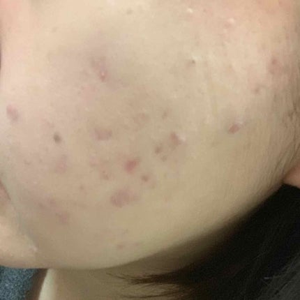 カラーステイ メイクアップ N/REVLON/リキッドファンデーションを使ったクチコミ(3枚目)