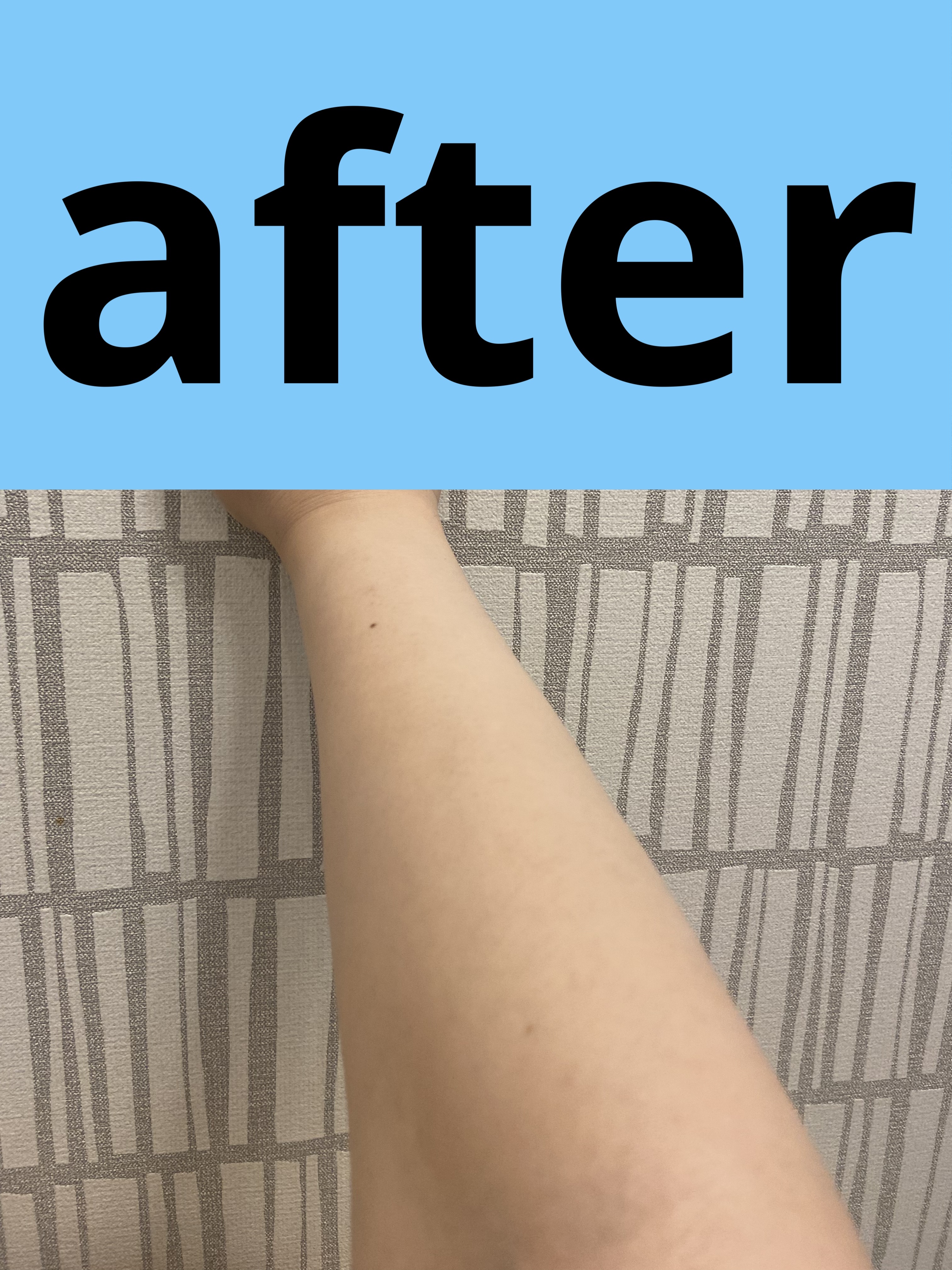 サンカットR ライトアップUV エッセンス/サンカット®/日焼け止めローションを使ったクチコミ（3枚目）