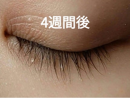 ダブルアップリペアアイラッシュセラム /EYE2IN/まつげ美容液を使ったクチコミ(3枚目)