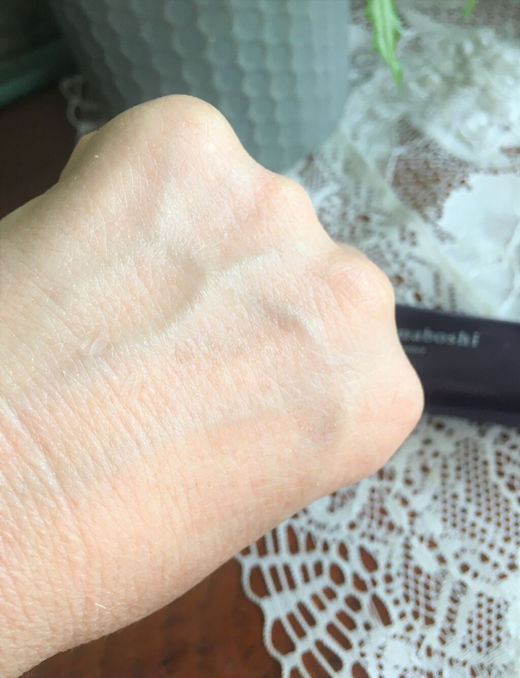 Wエッセンス/shimaboshi/美容液を使ったクチコミ(4枚目)