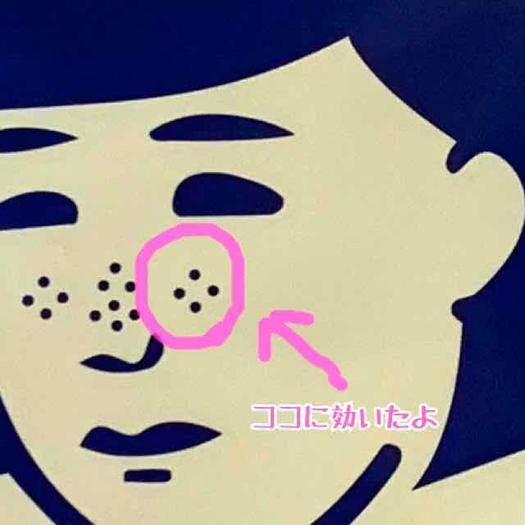 お米のマスク/毛穴撫子/シートマスク・パックを使ったクチコミ（2枚目）