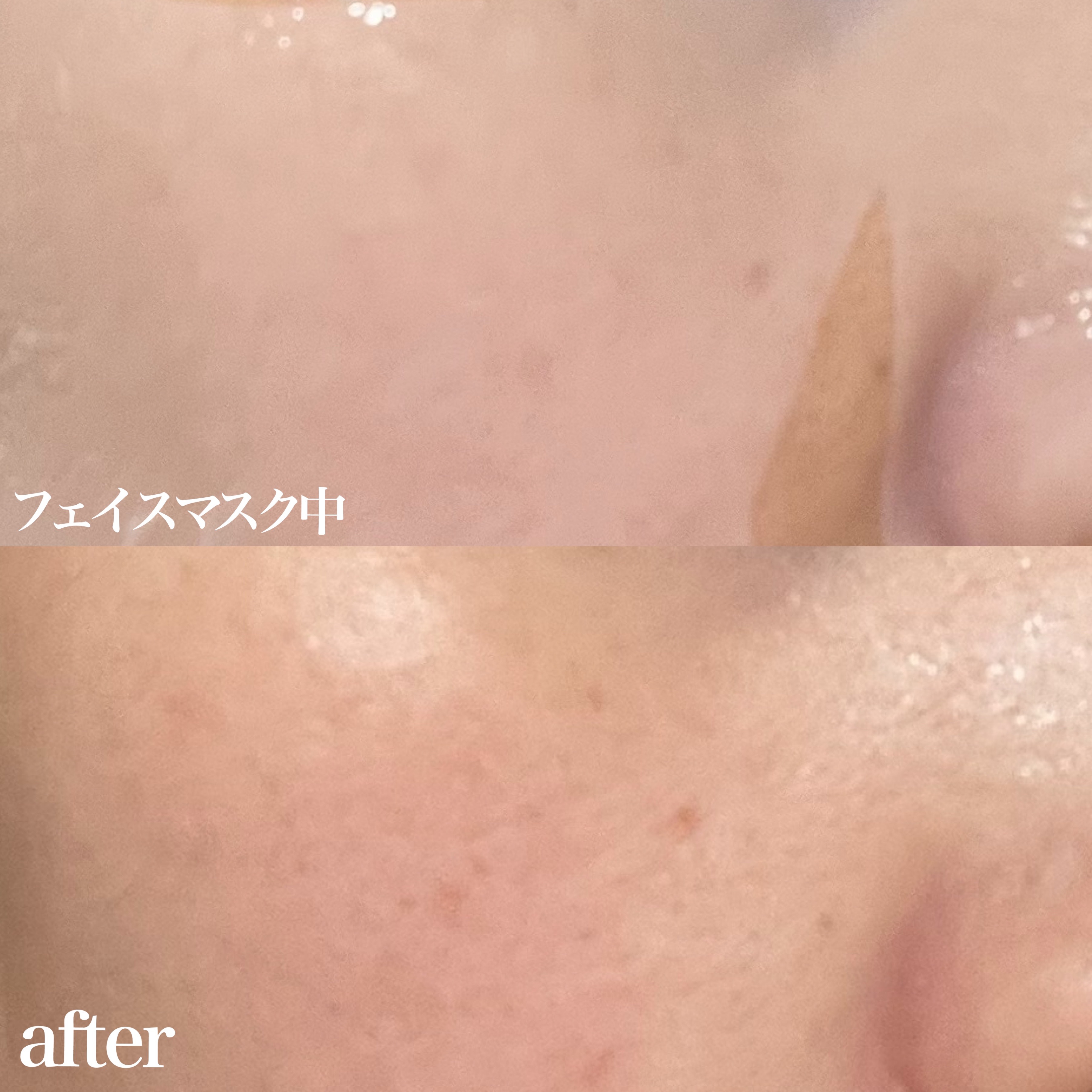 バイオチューン バイオセルロースマスク バランスタイプ/クリアターン/シートマスク・パックを使ったクチコミ（2枚目）