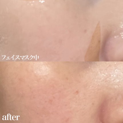 バイオチューン バイオセルロースマスク バランスタイプ/クリアターン/シートマスク・パックを使ったクチコミ(2枚目)