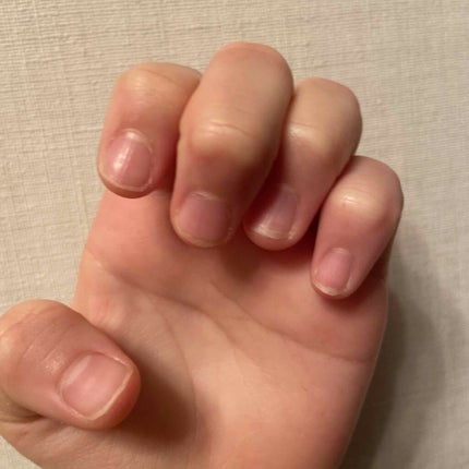 pink_blush_qqn on LIPS 「皆さん!こんにちはm(*__)m私の爪、、。丸くて汚いですね😭..」(1枚目)