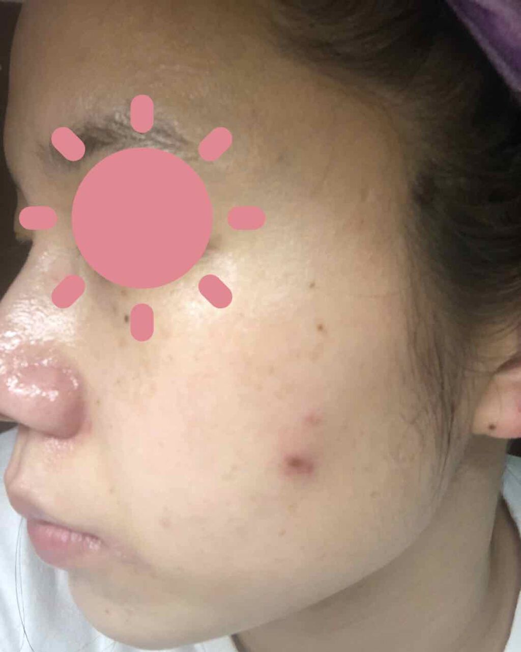 オバジC10セラム/オバジ/美容液を使ったクチコミ(1枚目)