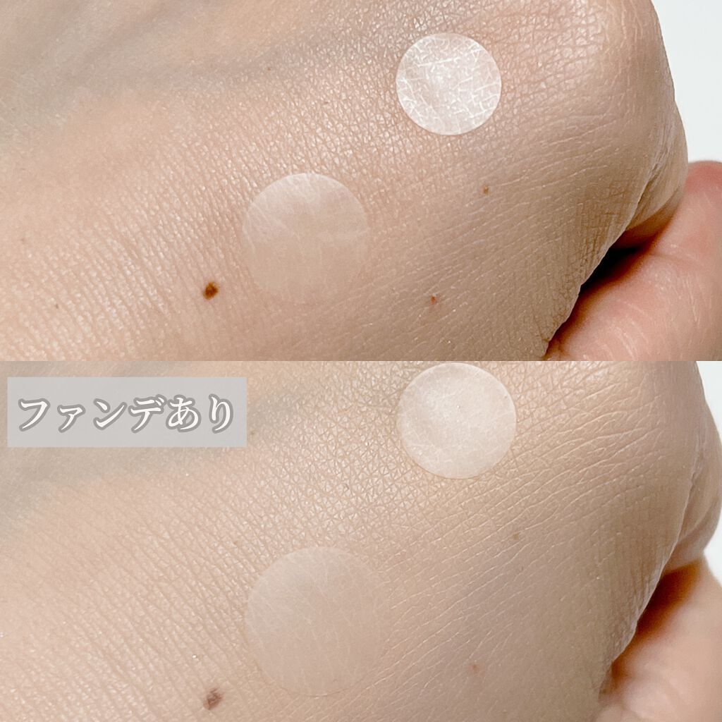 極薄透明パッチ nikipa!/金冠堂/にきびパッチを使ったクチコミ(5枚目)