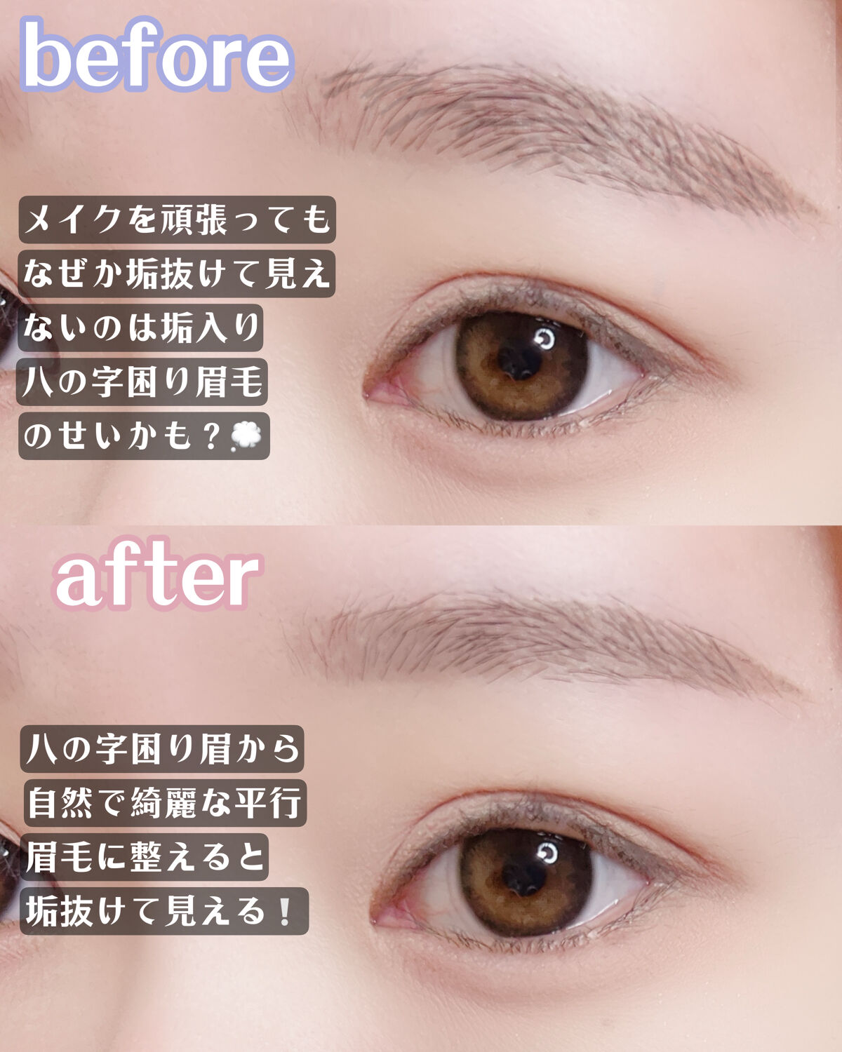 プレミア敏感肌用 Lディスポ/シック/シェーバーを使ったクチコミ（2枚目）