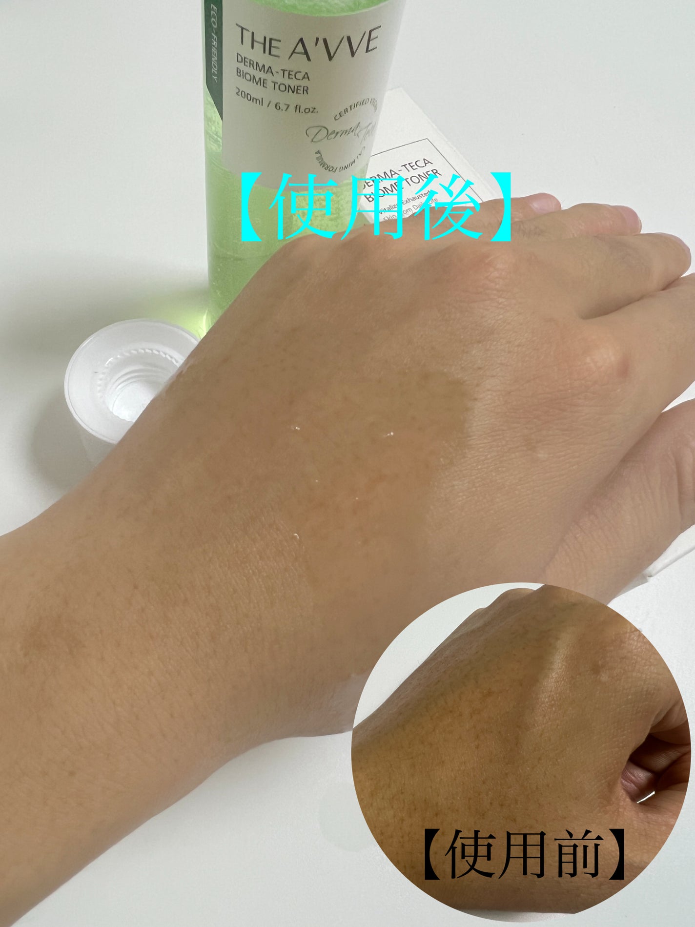 ダーマテカバイオームトナー/THE A'VVE/化粧水を使ったクチコミ(3枚目)