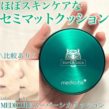 スーパーシカクッション/MEDICUBE/クッションファンデーションを使ったクチコミ（1枚目）