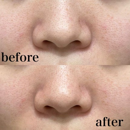 モデリングマスクパック/DAISO/シートマスク・パックを使ったクチコミ(5枚目)