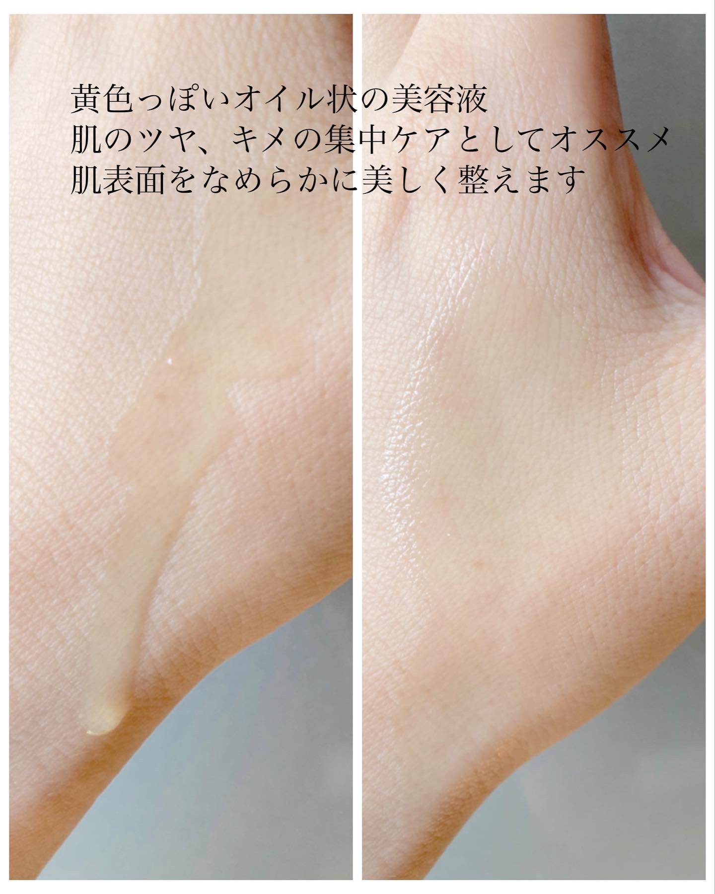 レニューピュアアクティブRT/エタピュール/美容液を使ったクチコミ（2枚目）