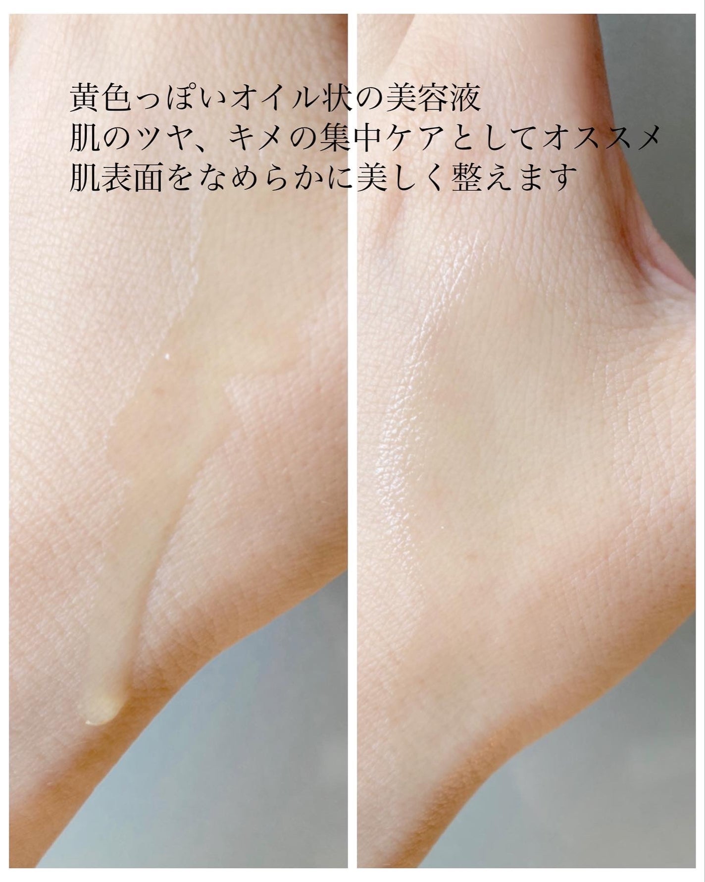 レニューピュアアクティブRT/エタピュール/美容液を使ったクチコミ(2枚目)