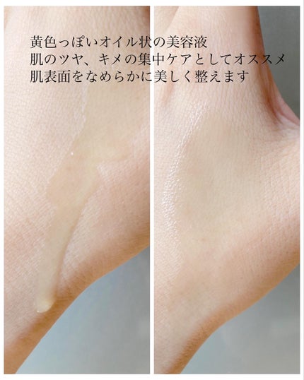 レニューピュアアクティブRT/エタピュール/美容液を使ったクチコミ(2枚目)