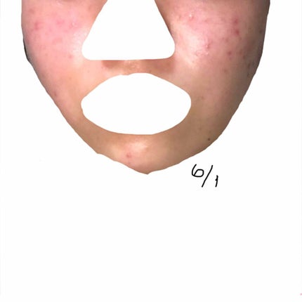 オリジナル ピュアスキンジェリー/ヴァセリン/ボディクリームを使ったクチコミ(2枚目)