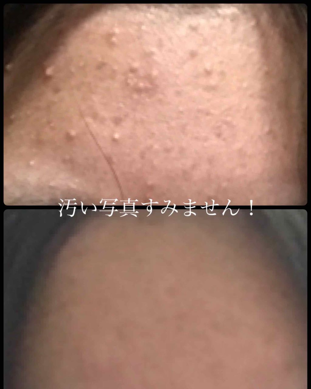 ハトムギ保湿ジェル(ナチュリエ スキンコンディショニングジェル)/ナチュリエ/美容液を使ったクチコミ(3枚目)