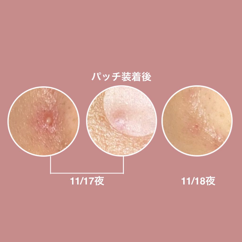 バルンソンリペアキット/SKINSBIBLE/その他スキンケアを使ったクチコミ（3枚目）